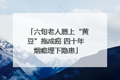 六旬老人唇上“黄豆”拖成癌 四十年烟瘾埋下隐患